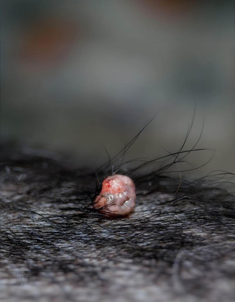 ALT text: Close-up of a mole on human skin with hair around it.