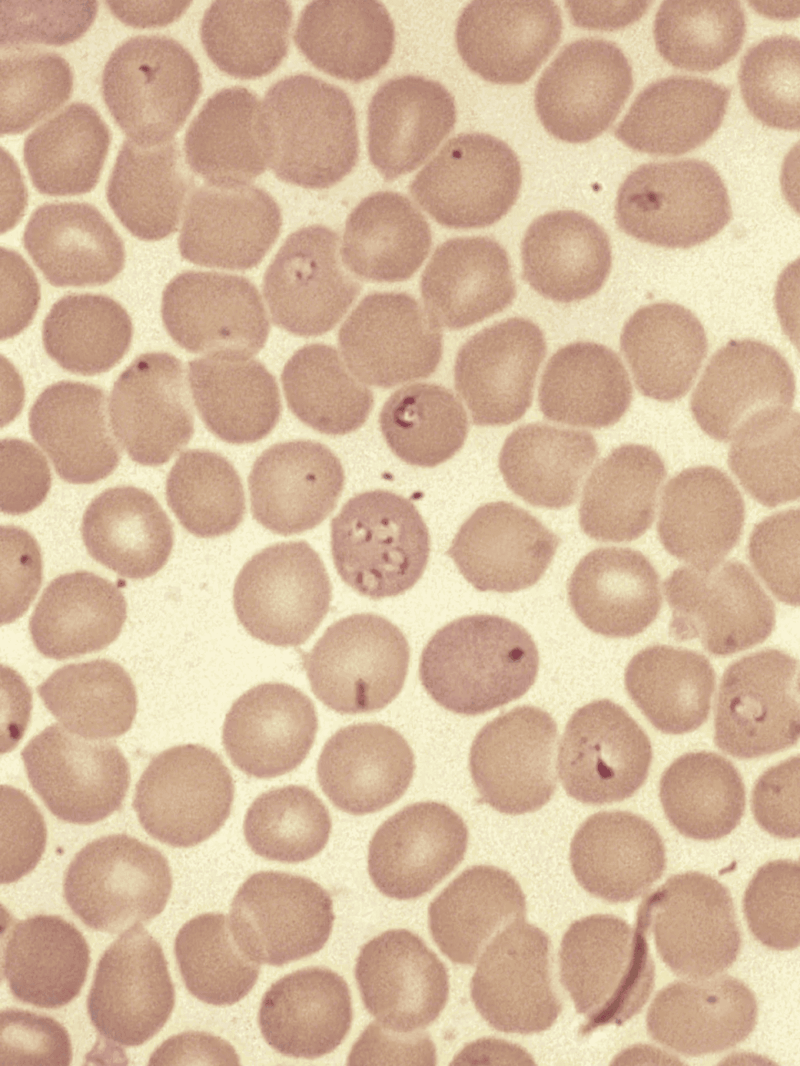 A close-up of blood cells showing healthy, round, and uniform blood cells. Essential for understanding blood health and circulation.