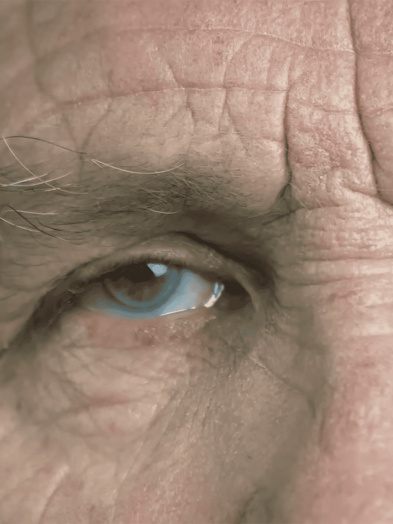 Close-up of an elderly person's eye showing skin texture and wrinkles for skincare tips.