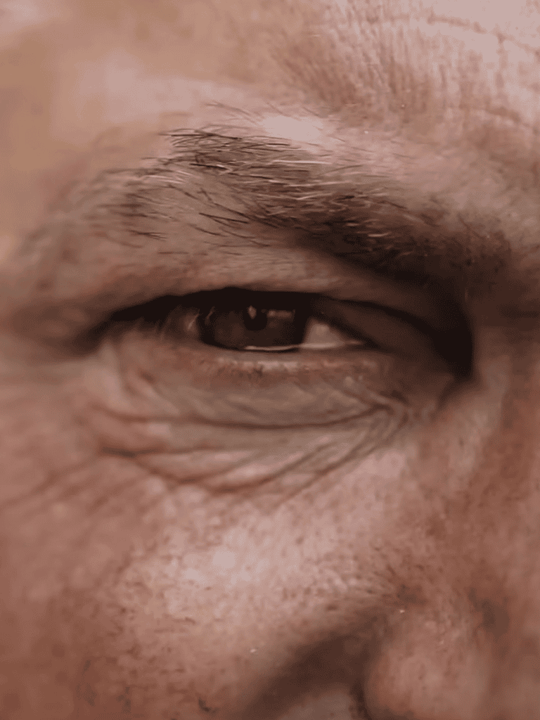 Close-up of a dog’s eye showing healthy eye and eyelid.